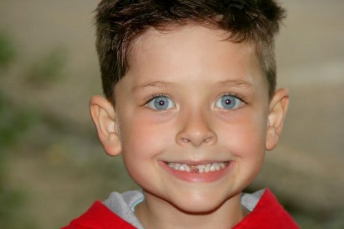 What to Do If Your Child Breaks a Tooth