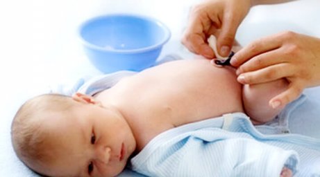How to Care for Your Newborn's Umbilical Cord Stump