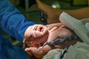 Why Women Donate the Umbilical Cord After Giving Birth