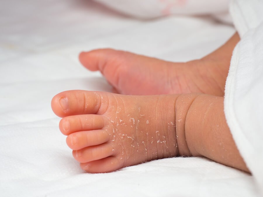 How to Care for Your Newborn’s Skin