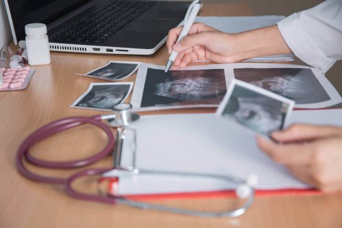 Everything You Need to Know About Sonograms