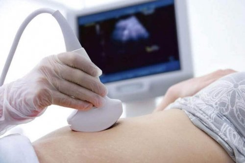 Woman getting sonogram