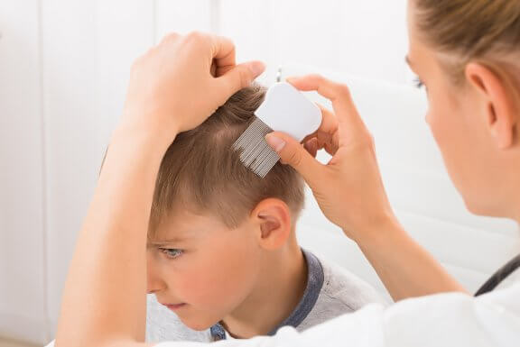 4 Remedies Against Psoriasis for Children