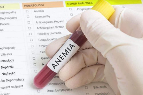 Anemia in Children: Causes, Prevention and Treatment