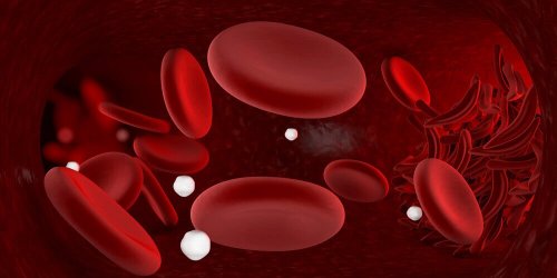 Anemia in Children: Causes, Prevention and Treatment