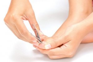 How to Treat Ingrown Toenails