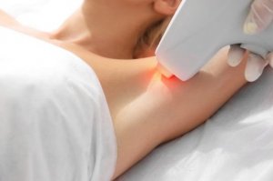 Can You Have Laser Hair Removal While Pregnant?