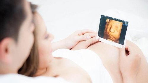 When Can You First Hear Your Baby's Heartbeat?
