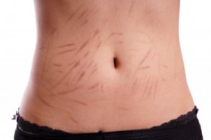 Self-Injury in Teenagers: What You Need to Know