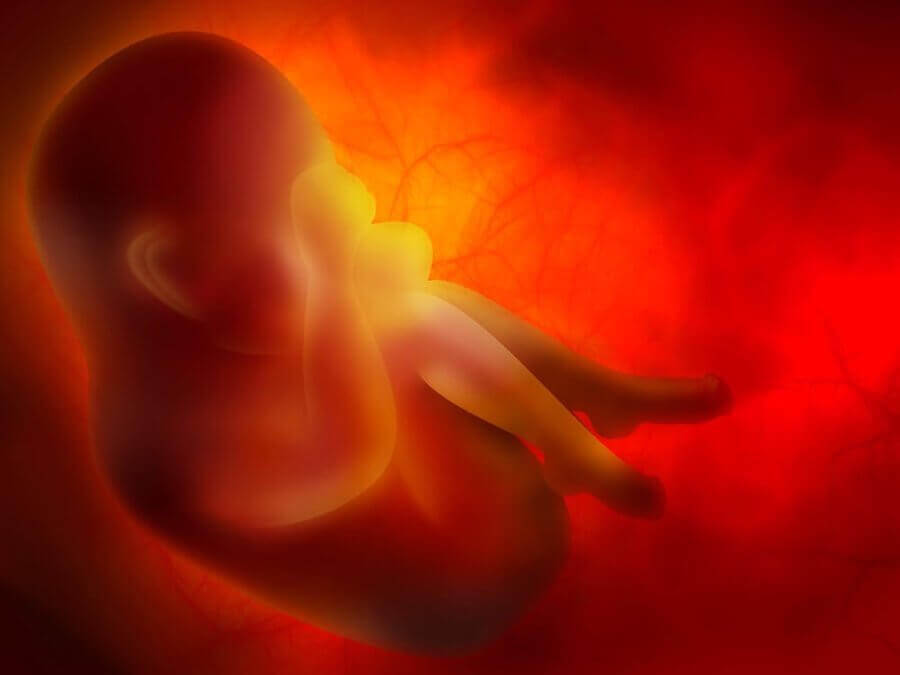 Twisted Umbilical Cord During Pregnancy and Childbirth