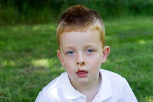 Contagious Impetigo in Children: Prevention and Treatment