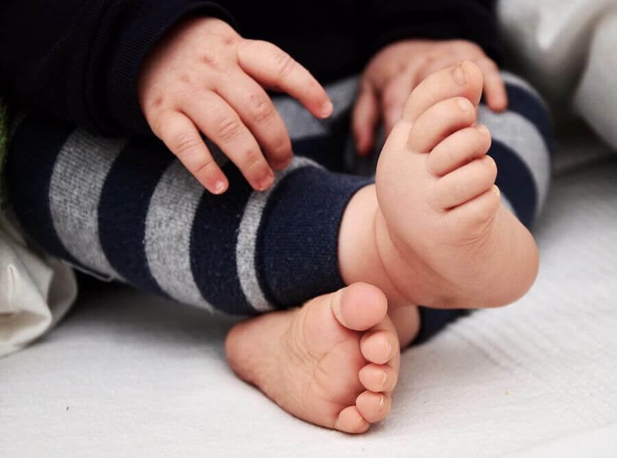 What to Do if Children Walk with Their Feet Turned Inward