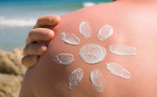 What Should You Do to Treat Sunburns?