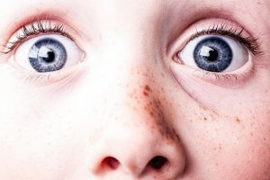 Apply Sunscreen for Moles and Freckles