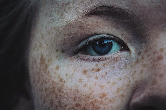 Apply sunscreen to prevent freckles from getting darker.
