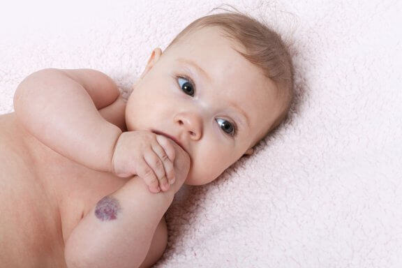 Common Craniofacial Anomalies in Babies