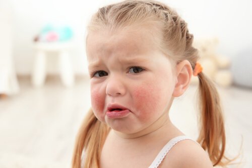Most Common Food Allergies in Children