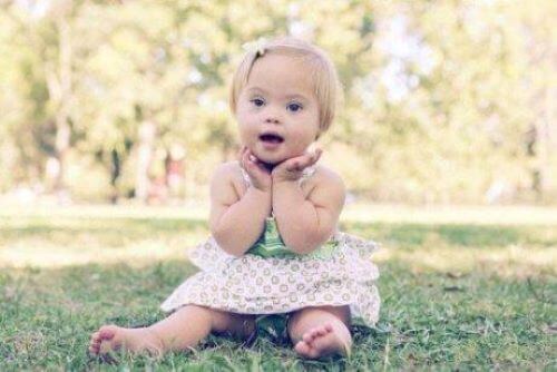 Autosomal Chromosome Disorders: What You Should Know