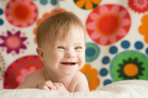 Autosomal Chromosome Disorders