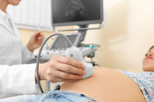 A pregnant woman getting an ultrasound.