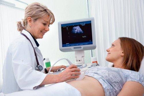 A pregnant woman smiling during an ultrasound.