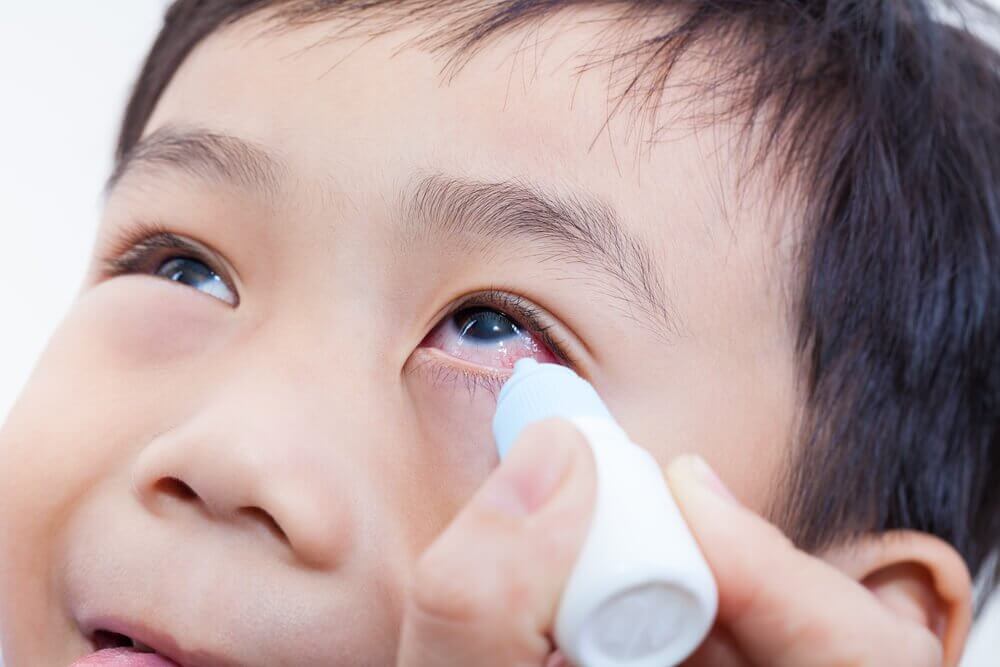Causes of Choroidal Effusions in Children