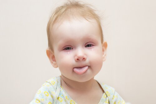 Conjunctivitis in Babies: How to Treat It