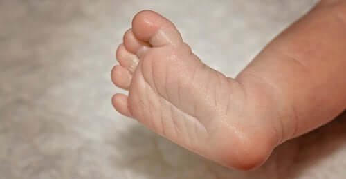 Everything You Need to Know About Flat Feet