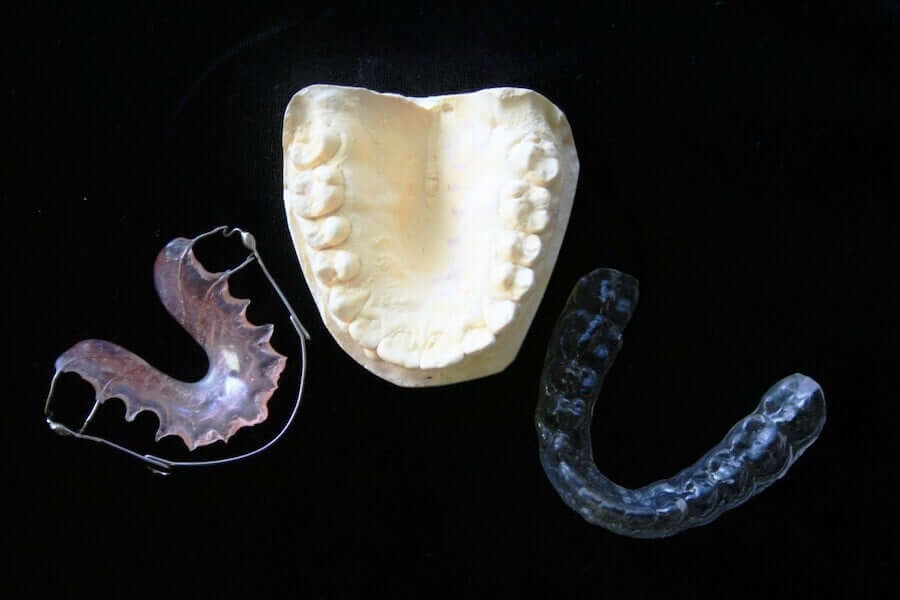 Orthodontics for Children: Removable or fixed