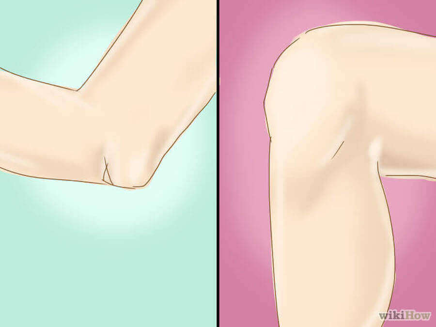 What Is Tendinitis and How Do You Relieve It?