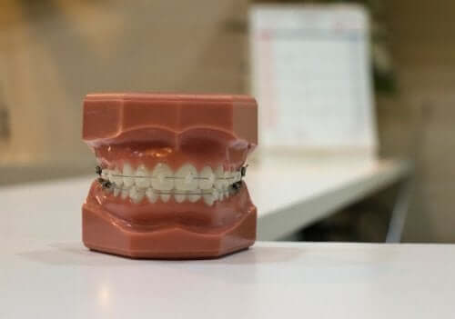 Orthodontics for Children: Removable or Fixed