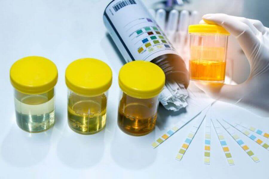 The Importance of Urine Tests During Pregnancy