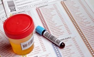 The Importance of Urine Tests During Pregnancy