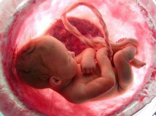 A baby inside the placenta.