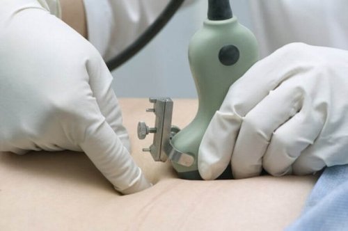 What's Hysterosalpingography (HSG)?