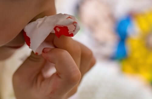 My Child Suffers from Frequent Nosebleeds: What Should I Do?