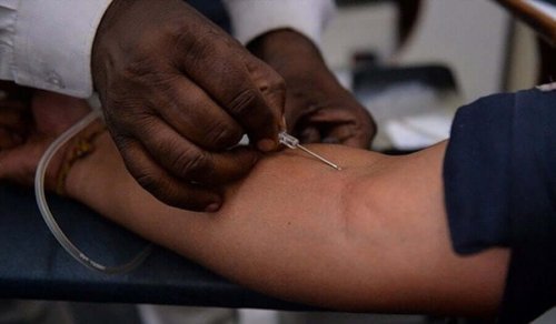 Children with HIV have to be treated quickly.