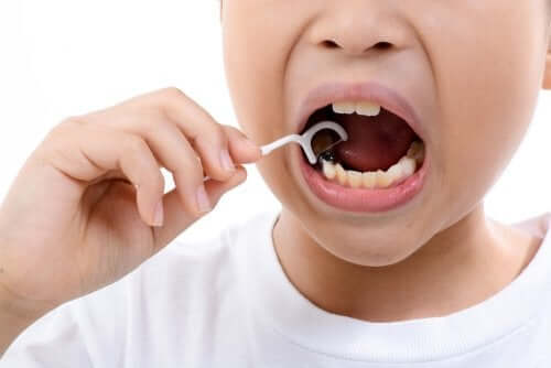 Dental Fluorosis in Children: What You Should Know