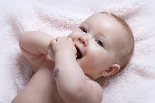 Infant Hemangiomas: Common Tumors in Infants