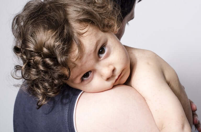 What Is Juvenile Dermatomyositis?