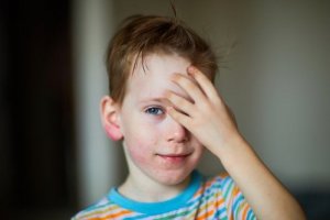 What Is Juvenile Dermatomyositis?
