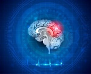 What Is Acquired Brain Injury in Children?