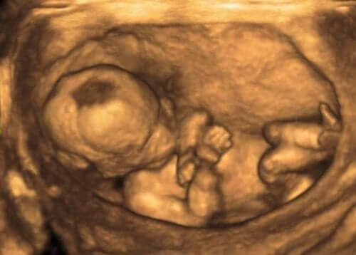 Very Interesting Facts About Amniotic Fluid