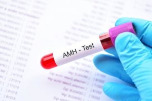 What Is the Anti-Müllerian Hormone?