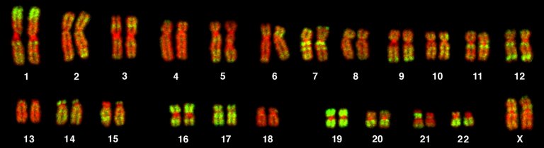 Genetic Syndromes: What Are They and How Are They Inherited?