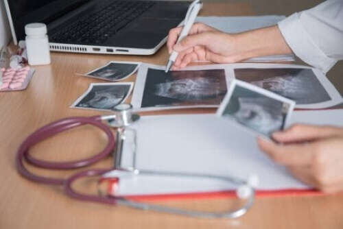 Prenatal Checkups During Pregnancy