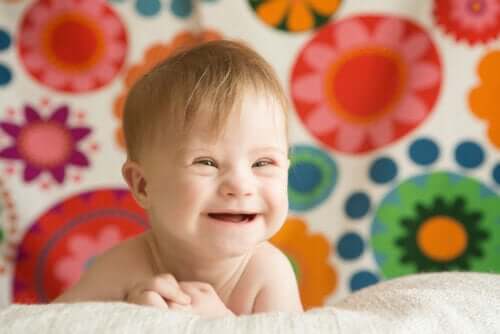 Breastfeeding and Babies with Down Syndrome