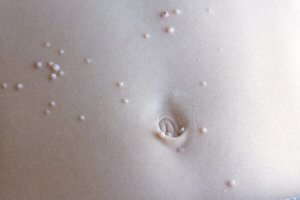 What to Do If Your Child Has Molluscum Contagiosum (MC)