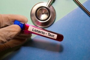 Neonatal Listeriosis: An Illness that Deserves Our Attention