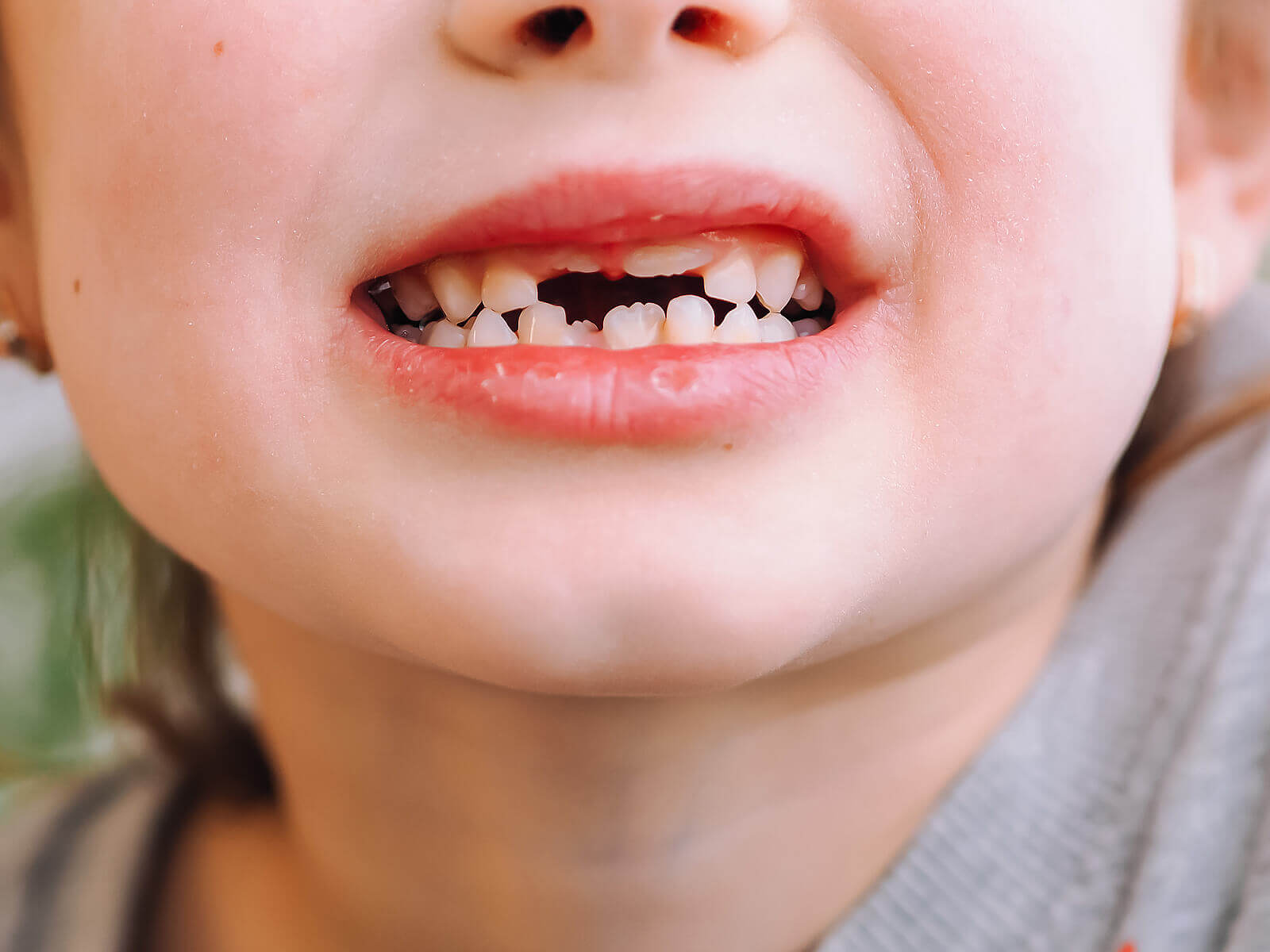 Bumps to Baby Teeth: What to Do